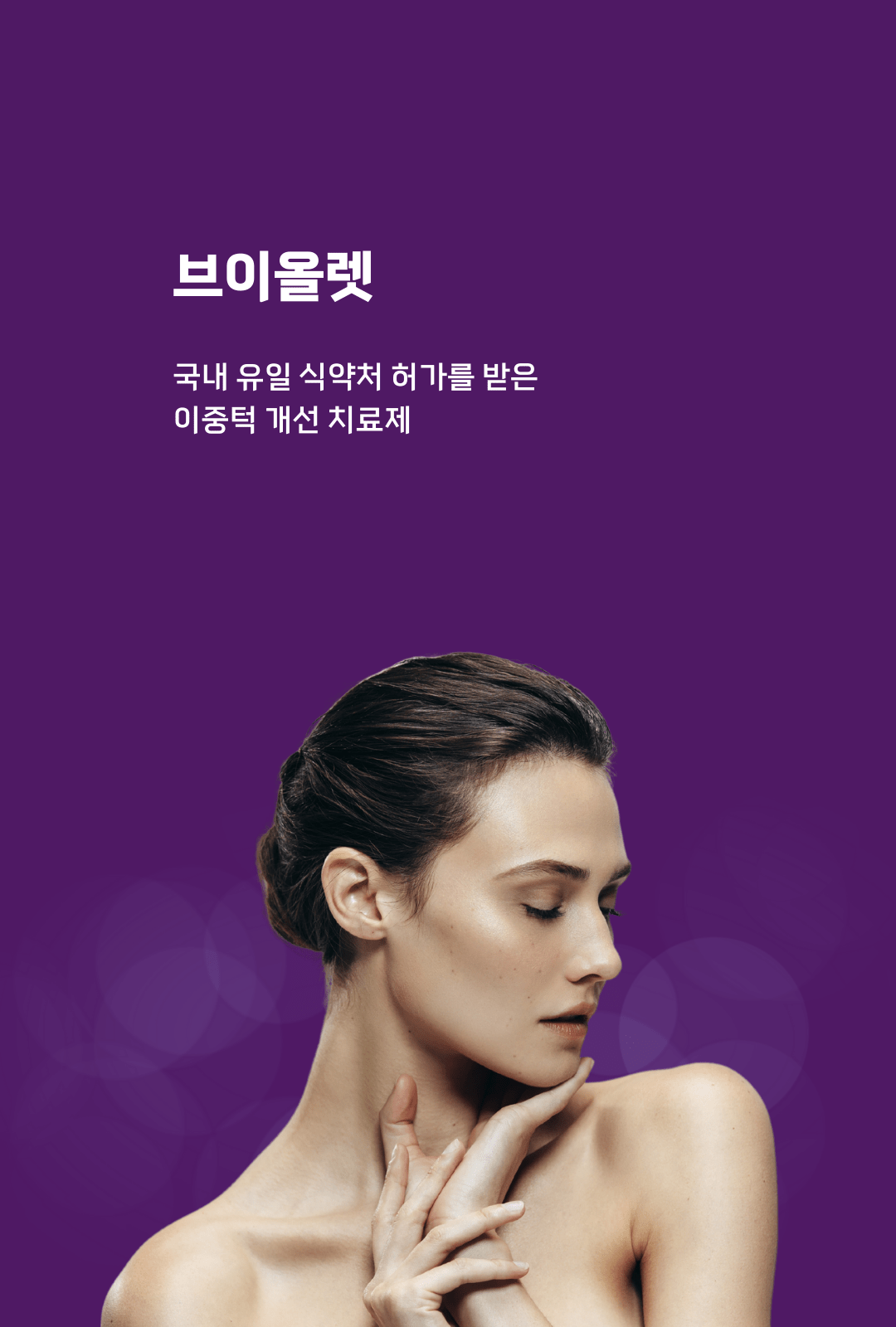 수원리쥬란